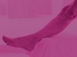 Ретикулярный варикоз нижних конечностей: симптомы и лечение