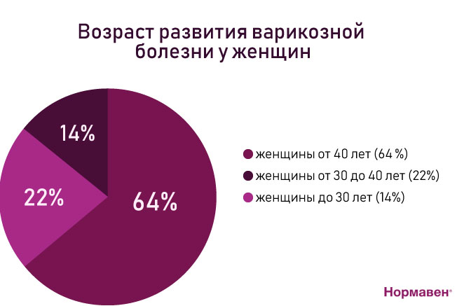 варикоз у женщин