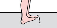 Профилактика варикозного расширения вен ног упражнения