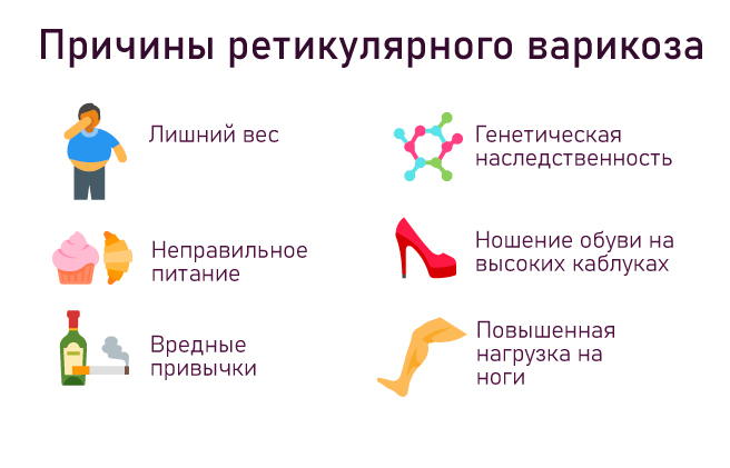 ретикулярный варикоз причины