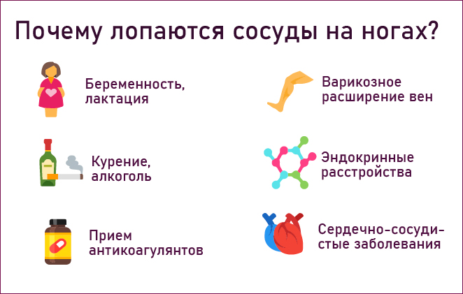 сосуды на ногах