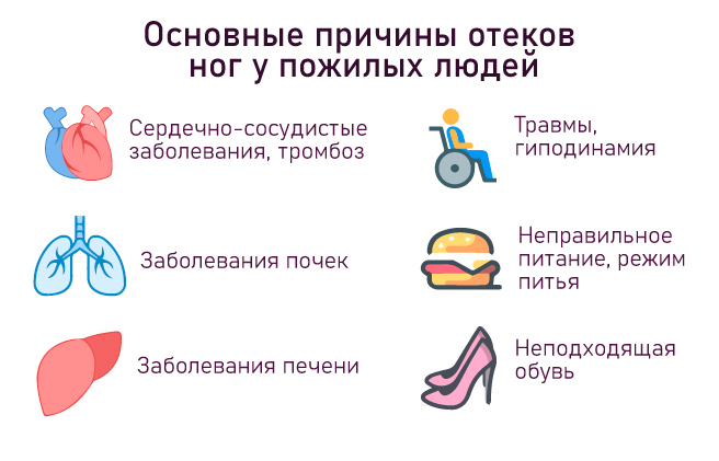 причины отеков ног