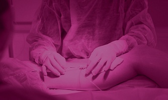 Хирургическое вмешательство и малоинвазивное оперативное лечение варикозной болезни вен нижних конечностей: необходимость, подготовка, реабилитация и возможные последствия